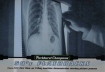 2022-23 Parkhurst Champions 50s Flashbacks #FB14 X-Ray Machine