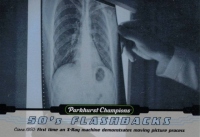 2022-23 Parkhurst Champions 50s Flashbacks #FB14 X-Ray Machine
